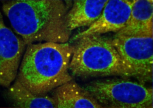 [10219-1-AP-150UL] EIF3D Polyclonal antibody