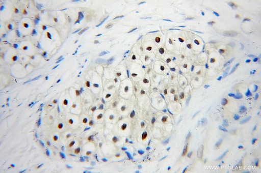 [10224-1-AP-20UL] UBC9 Polyclonal antibody