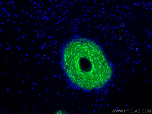 [10225-1-AP-150UL] CRABP2 Polyclonal antibody