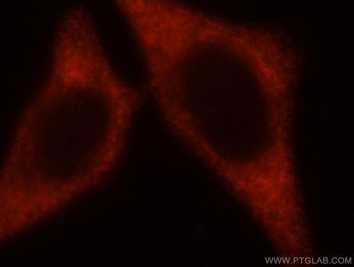 [10227-1-AP-20UL] EIF2S2 Polyclonal antibody