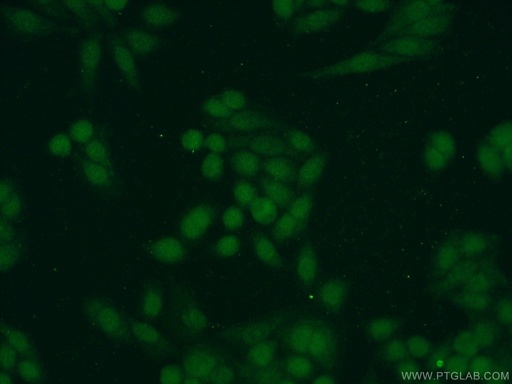 [10229-1-AP-20UL] SAE1 Polyclonal antibody