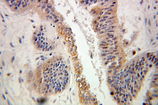 [10232-1-AP-20UL] ARL2 Polyclonal antibody