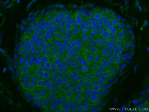 [10233-1-AP-150UL] NDE1 Polyclonal antibody