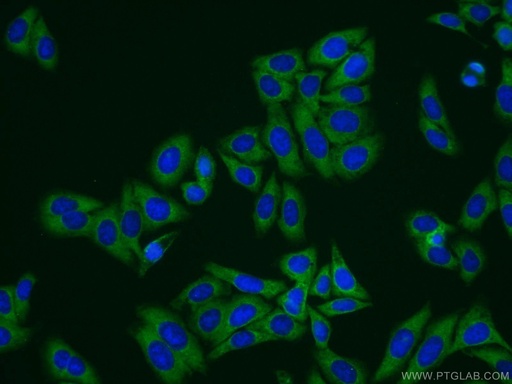 [10234-2-AP-150UL] Transgelin 2 Polyclonal antibody