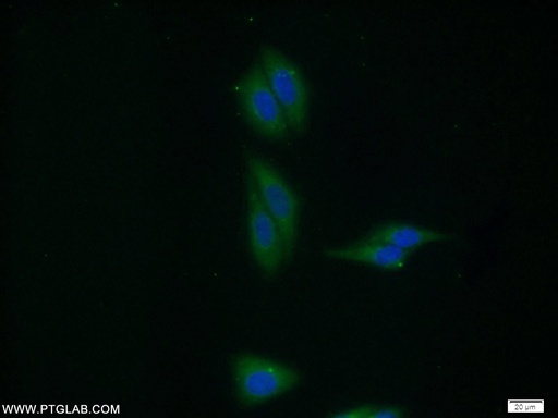[10236-1-AP-20UL] VPS35 Polyclonal antibody