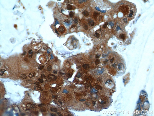 [10243-1-AP-150UL] UBC13 Polyclonal antibody