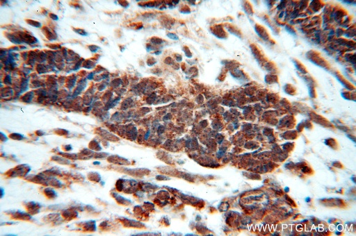 [10255-1-AP-20UL] HDAC3 Polyclonal antibody