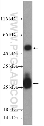 [10283-1-AP-150UL] Mouse-IgG Polyclonal antibody