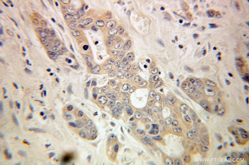 [10296-1-AP-20UL] Torsin A Polyclonal antibody