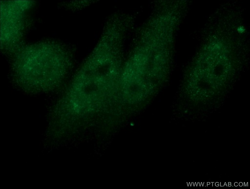 [10328-1-AP-150UL] NXF1 Polyclonal antibody