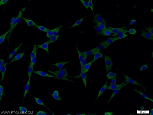 [10340-1-AP-20UL] RAB6B Polyclonal antibody