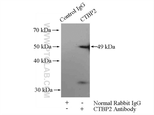 [10346-1-AP-150UL] CTBP2 Polyclonal antibody