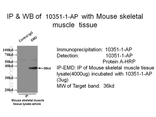 [10351-1-AP-150UL] Emerin Polyclonal antibody