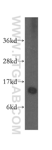 [10352-1-AP-20UL] SNRPD1 Polyclonal antibody