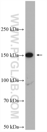 [10395-1-AP-20UL] FMNL1 Polyclonal antibody