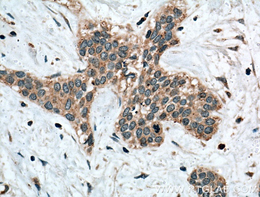 [10415-1-AP-20UL] Calpain 3 Polyclonal antibody