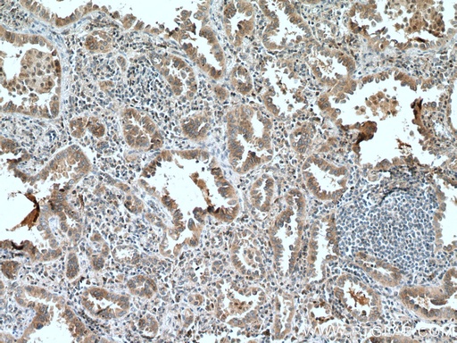[10420-1-AP-20UL] SLC25A3 Polyclonal antibody