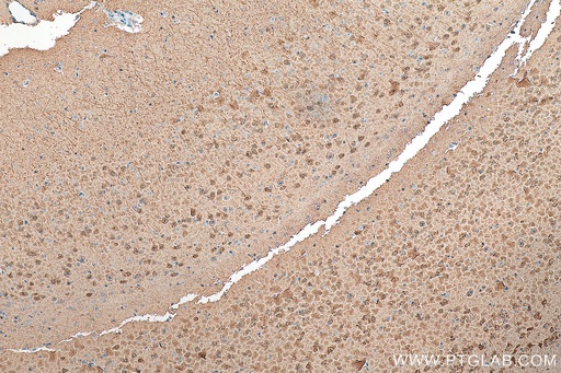 [10440-1-AP-150UL] Neurogranin Polyclonal antibody