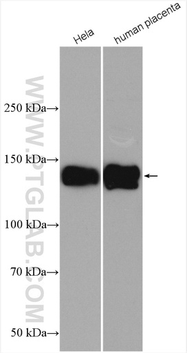 [10569-1-AP-20UL] Integrin Alpha-5 Polyclonal antibody