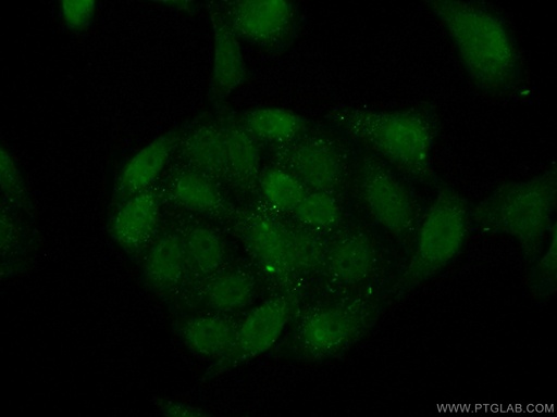 [10606-1-AP-20UL] CSNK2A2 Polyclonal antibody