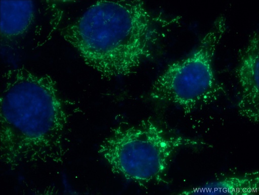 [10627-1-AP-20UL] FADS1 Polyclonal antibody