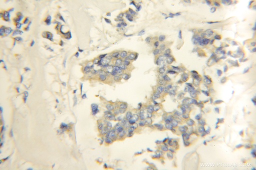 [10629-1-AP-150UL] RNF34 Polyclonal antibody