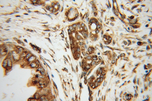 [10630-1-AP-150UL] EEF1D Polyclonal antibody