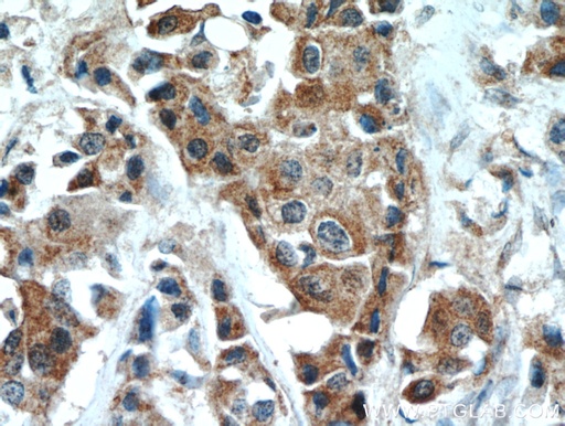 [10636-1-AP-20UL] DLK1 Polyclonal antibody