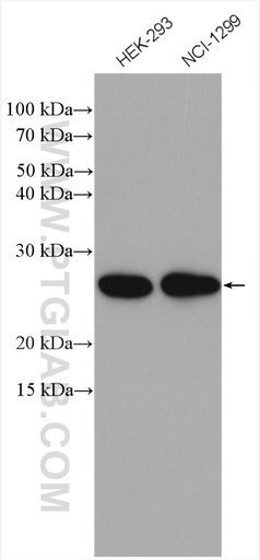 [10640-1-AP-20UL] EIF3K Polyclonal antibody