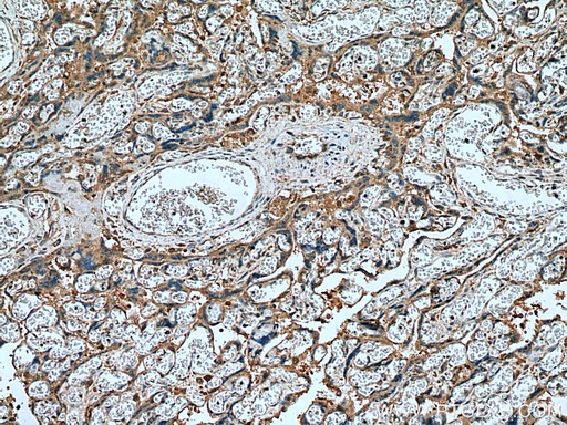 [10642-1-AP-20UL] Placental Growth Factor Polyclonal antibody
