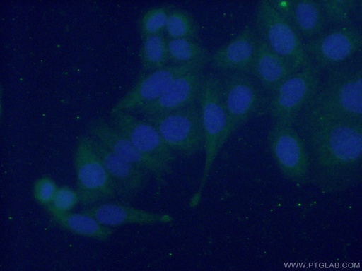 [10643-1-AP-150UL] EMILIN1 Polyclonal antibody