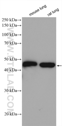 [11227-1-AP-150UL] Gamma Actin Polyclonal antibody