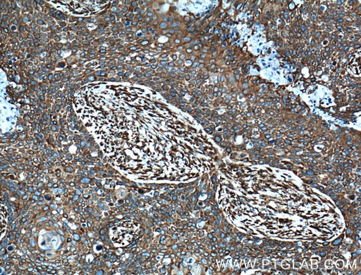 [11229-1-AP-150UL] MAP4 Polyclonal antibody