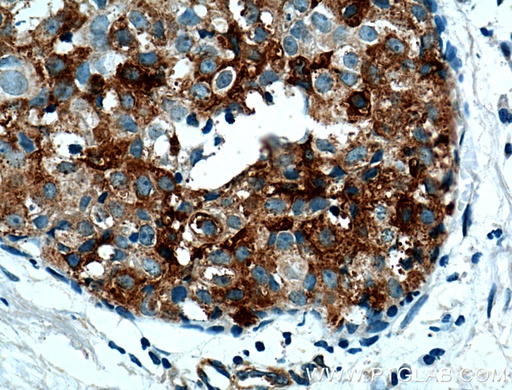[11230-1-AP-20UL] Casein Kinase 1 Epsilon Polyclonal antibody