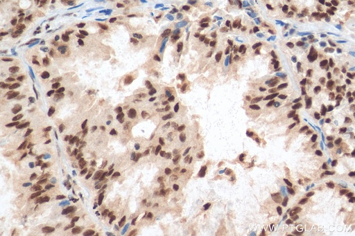 [11231-1-AP-150UL] SETDB1 Polyclonal antibody