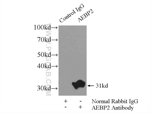 [11232-2-AP-150UL] AEBP2 Polyclonal antibody