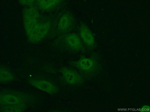[11235-2-AP-150UL] CREB3L1,OASIS Polyclonal antibody
