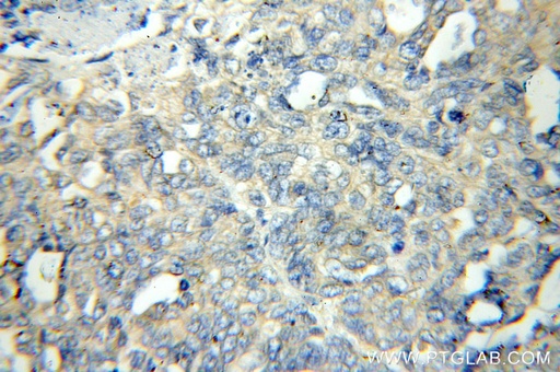 [11236-2-AP-20UL] FLCN Polyclonal antibody