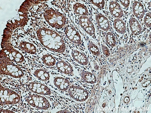 [11237-1-AP-20UL] MIRO2 Polyclonal antibody