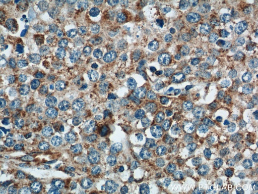 [11238-1-AP-150UL] NDUFV1 Polyclonal antibody