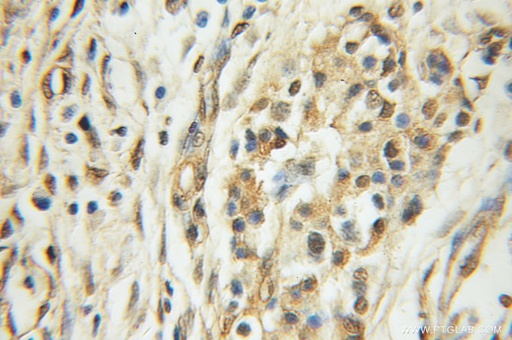 [11243-1-AP-150UL] ARHGEF18 Polyclonal antibody