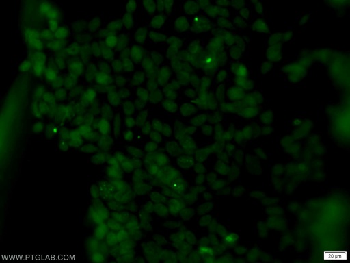 [11251-1-AP-20UL] SUMO2/3 Polyclonal antibody