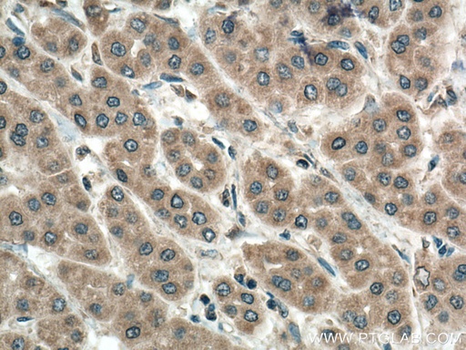 [11252-2-AP-150UL] PMM1 Polyclonal antibody