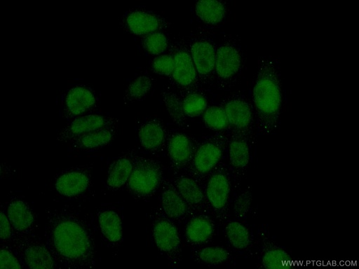 [11255-1-AP-150UL] RAD51AP1 Polyclonal antibody
