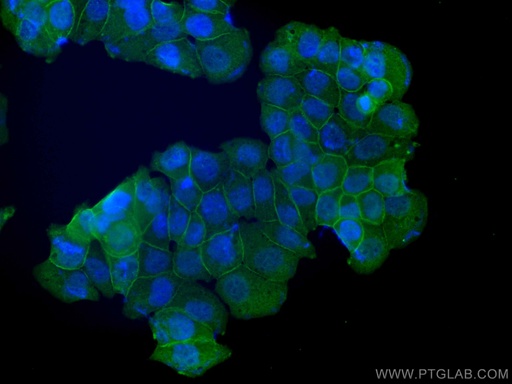 [11256-1-AP-20UL] Annexin A2 Polyclonal antibody
