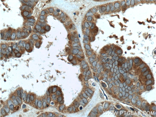 [11259-1-AP-150UL] FMN2 Polyclonal antibody