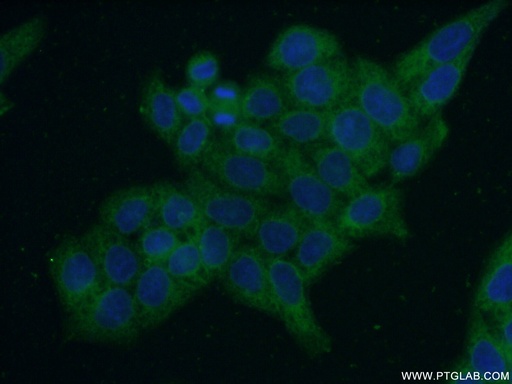 [11261-2-AP-150UL] ERO1LB Polyclonal antibody