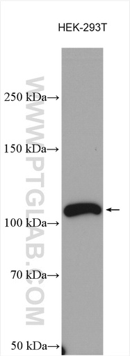 [11267-1-AP-20UL] XRN2 Polyclonal antibody