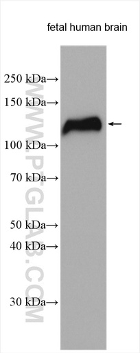 [11268-1-AP-150UL] NELL2 Polyclonal antibody