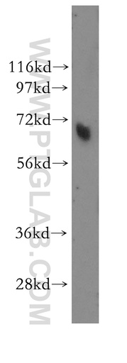 [11270-1-AP-150UL] MBD4 Polyclonal antibody